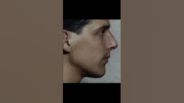 Dr Mike mew 3 year treatment #mewing