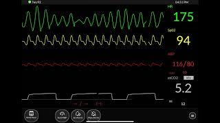 Hospital Monitor Part 2 - ICU