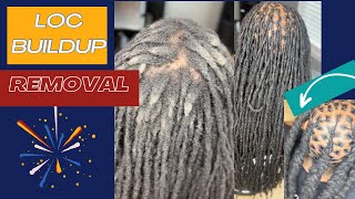 LOC DANDRUFF REMOVAL | NO ACV RINSE