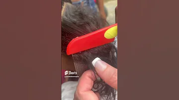 How Are Lice Removed Use A Fine Comb To Remove Nits And Lice From Damp Hair Hair License Nits 