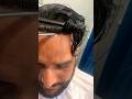 Youtubeshorts hairpatch lucky hair solution hair hairlook