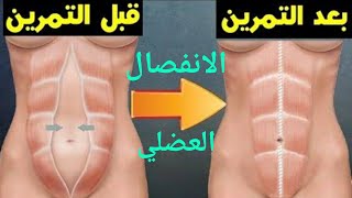 شرح الانفصال العضلي لبطن وكيفيه التخلص منه Explanation of muscle separation and how to get rid of it