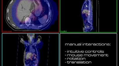 Medical Image Registration