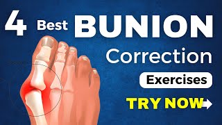 Bunion Pain Relief and Correction Exercises. Try these effective exercises for Foot Pain Relief.