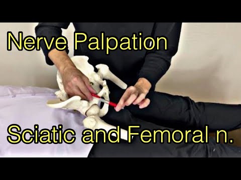 How to palpate sciatic nerve and femoral nerve (English)