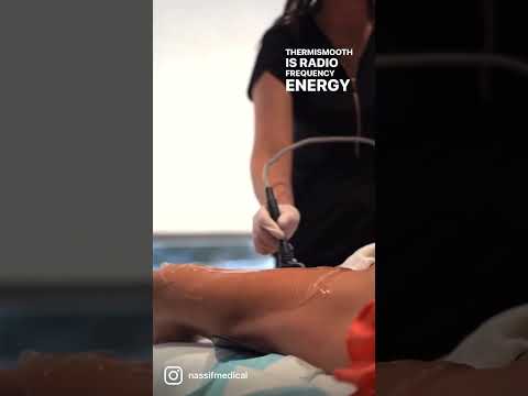 ThermiSmooth Treatment |