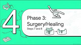 Digital Implant Surgery Workflow: Step-by-Step Guide | Guided4Excellence