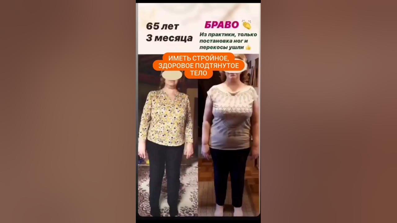 Как избавиться от искривлений плоскостопия, болей в спине, обрести ...