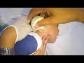 Removing Something from Boy&#39;s Ear Using A Bulb Syringe