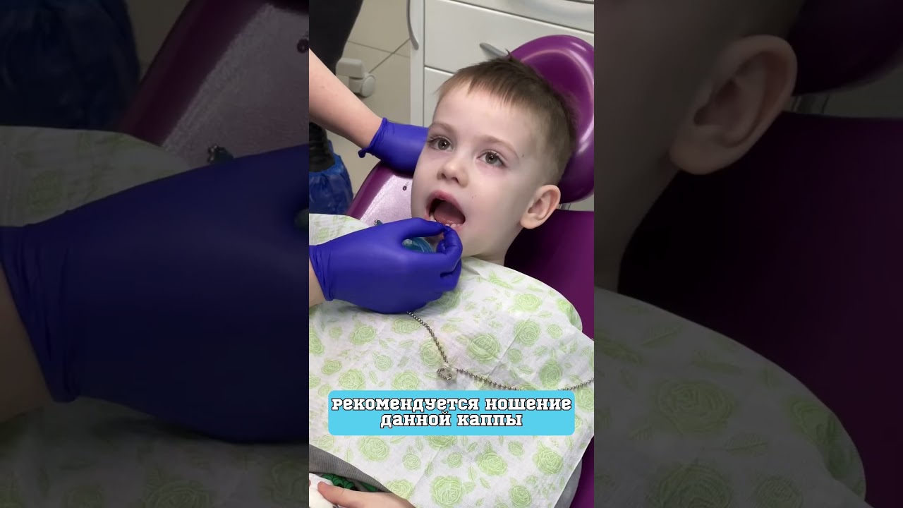Что такое ортодонтическая каппа и зачем она нужна? Разбираемся! #shorts