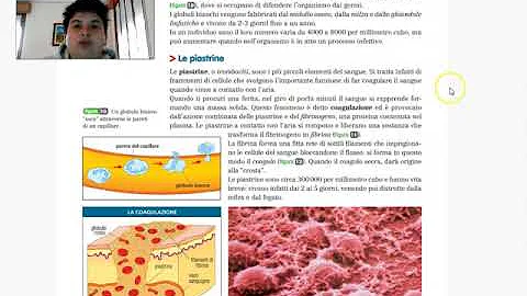 Cosa comporta la carenza di globuli bianchi?