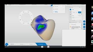 Designing Tooth #12 in CEREC SW 5.1.3