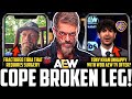 Aew adam copeland broken leg injury  tony khan uhappy with wbd tv offer  wwe becky lynch hiatus