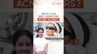 Which Acne Scar Treatment Is Right for You? | Dr Aishwarya Reddy | CasaDerma | #laser #skincare