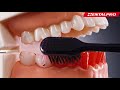 デンタルプロ歯ブラシ ブラック・シリーズ /  Dental Pro Toothbrushes - Black series