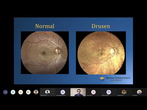 Video Macular Degeneration and the Latest Research - Low... - youtube