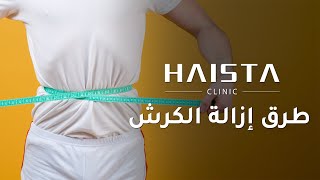 كيف تتخلص من دهون البطن في ليلة واحدة  | HAISTA CLINIC