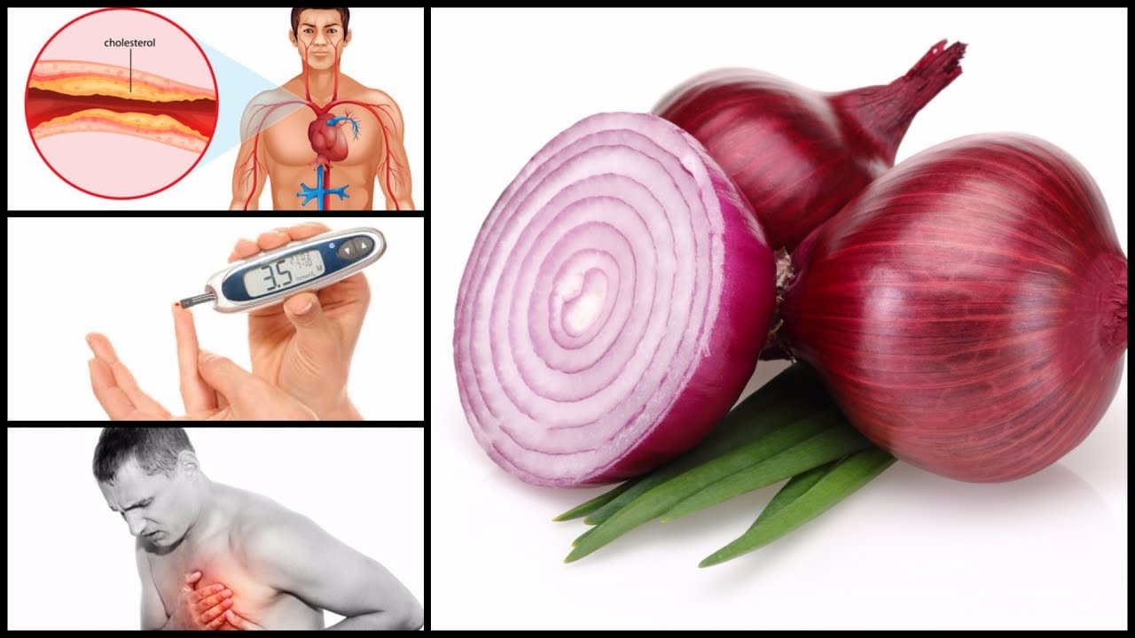 8 फायदे कच्चे प्याज खाने के, जानकर आप दंग रह जाएंगे Benefits of