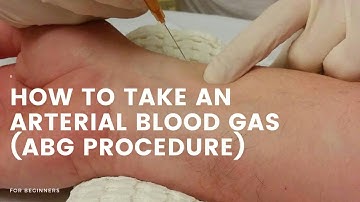 How to take blood for ABG | Radial Artery