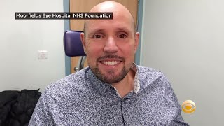 Famous Man Who Received World’s First 3D Printed Prosthetic Eye Says It ‘Looks Fantastic’ Profile