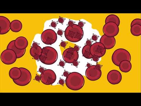 Что такое ВИЧ? Способы передачи, основные риски заболевания. Жизнь с ВИЧ.