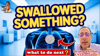 Kids Foreign Body Ingestion – What Every Parent Must Know | ProHealthConsults
