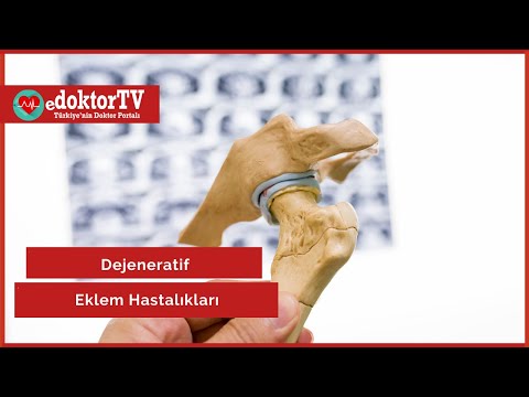 Dejeneratif Eklem Hastalıkları