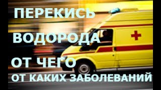 Перекись водорода - от каких болезней помогает. Перекись водорода - от каких болезней помогает.