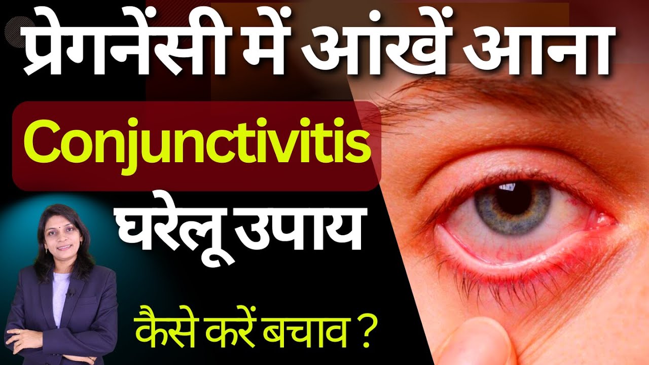 प्रेगनेंसी में कॉन्जंक्टिवाइटिस सावधानियां।Dr Sanjivani# Conjunctivitis Precautions In Pregnancy.