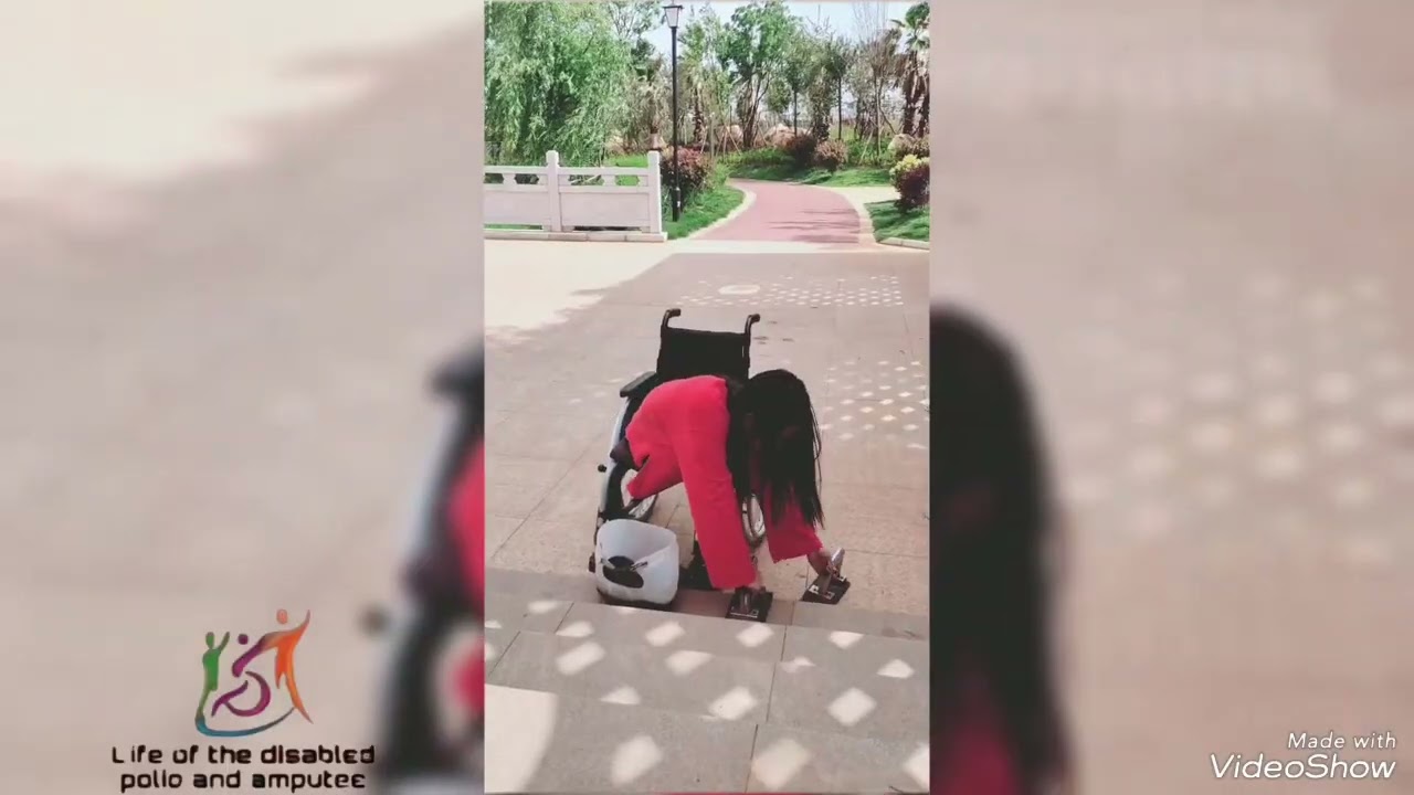 The beautiful woman has amputated legs and life without legs 