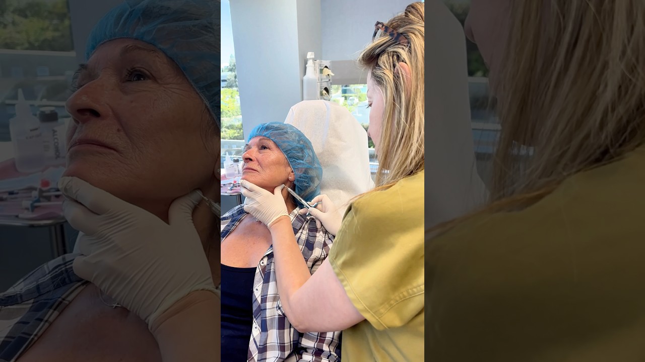 Banner for How to Enhance Your Jawline Without Filler | Skin Tightening and Fat Reduction #kybella #jawline