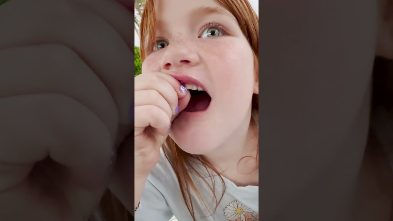 WiGGLE TOOTH Check With ADLEY About To Lose A BABY Tooth On Vacation Really Wiggly Teeth 