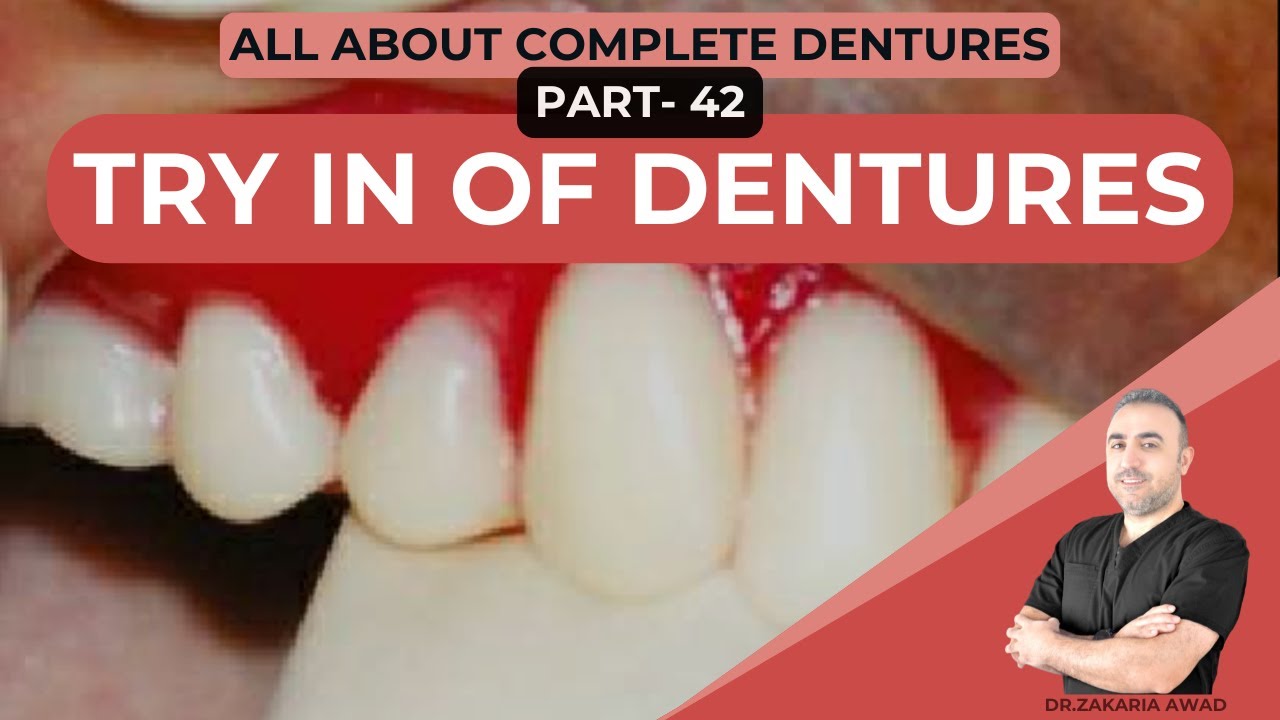 42- جلسة تجربة التعويض المتحرك: دليل خطوة بخطوة لنتائج مثالية - Denture Try-In