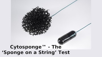 Cytosponge™ - The ‘Sponge on a String’ Test