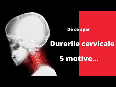 Video: Ce Se Poate Face și Nu Se Poate Face Cu Osteocondroză?