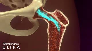 Cerule Stemenhance Ultra De Cerule Fr Hd