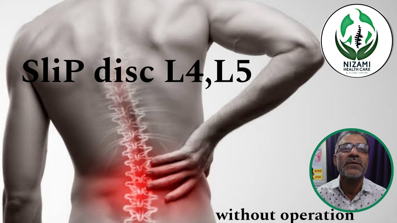 SliP disc case relief in 15 days L4_L5 without operation 