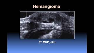 Ultrasound of the Hand and Wrist screenshot 4