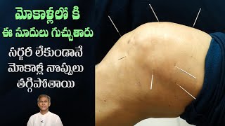 Get Knee Pain Relief Quickly Acupuncture Benefits Reduces Joint Pains Dr Manthen