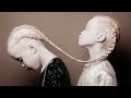 «Темнокожие альбиносы»: как сейчас выглядят уникальные сестры-близнецы Лара и Мара Бавар