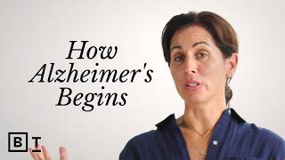 These 5 things reduce your probability of developing Alzheimer's | Lisa Genova