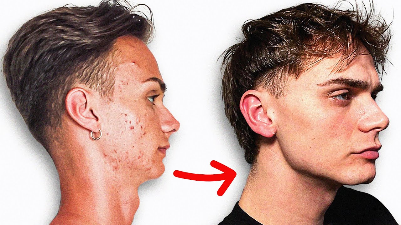 7 errores (comunes) que están j*diendo tu mandíbula