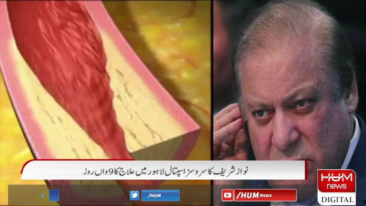 Nawaz Sharif undergoing medical treatment