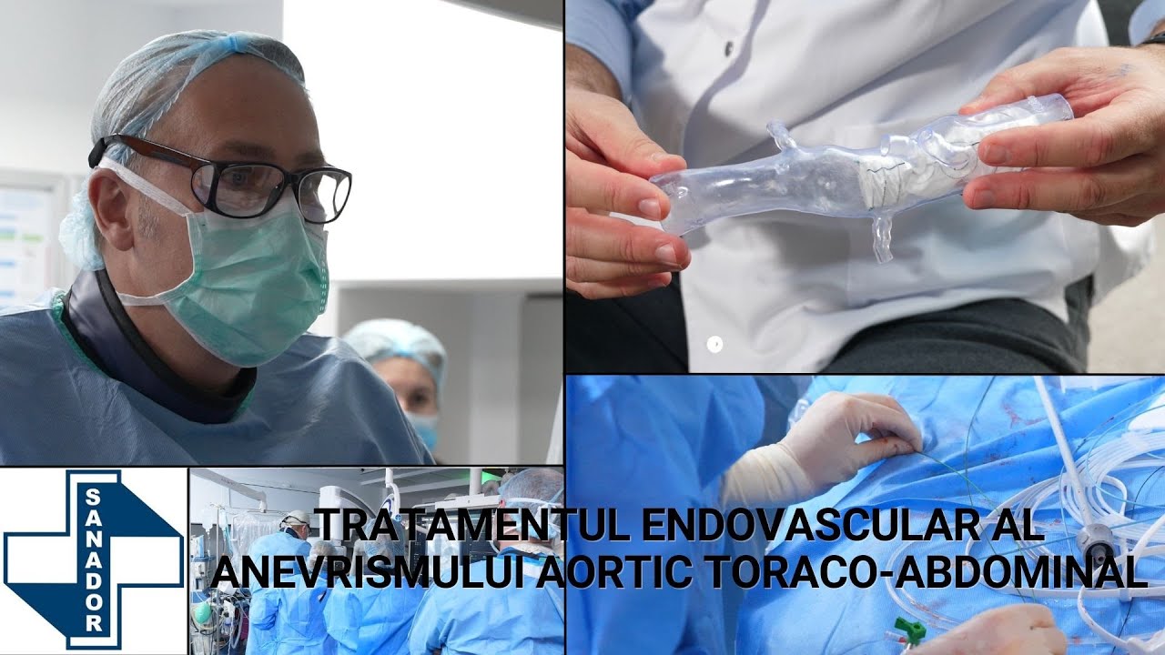 Tratamentul anevrismului aortic toraco-abdominal – Prof. Dr. Victor Costache | SANADOR