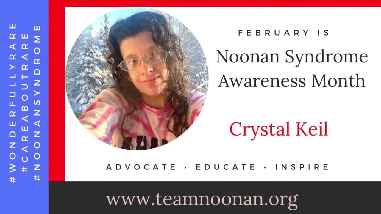 Noonan syndrome awareness facts YouTube