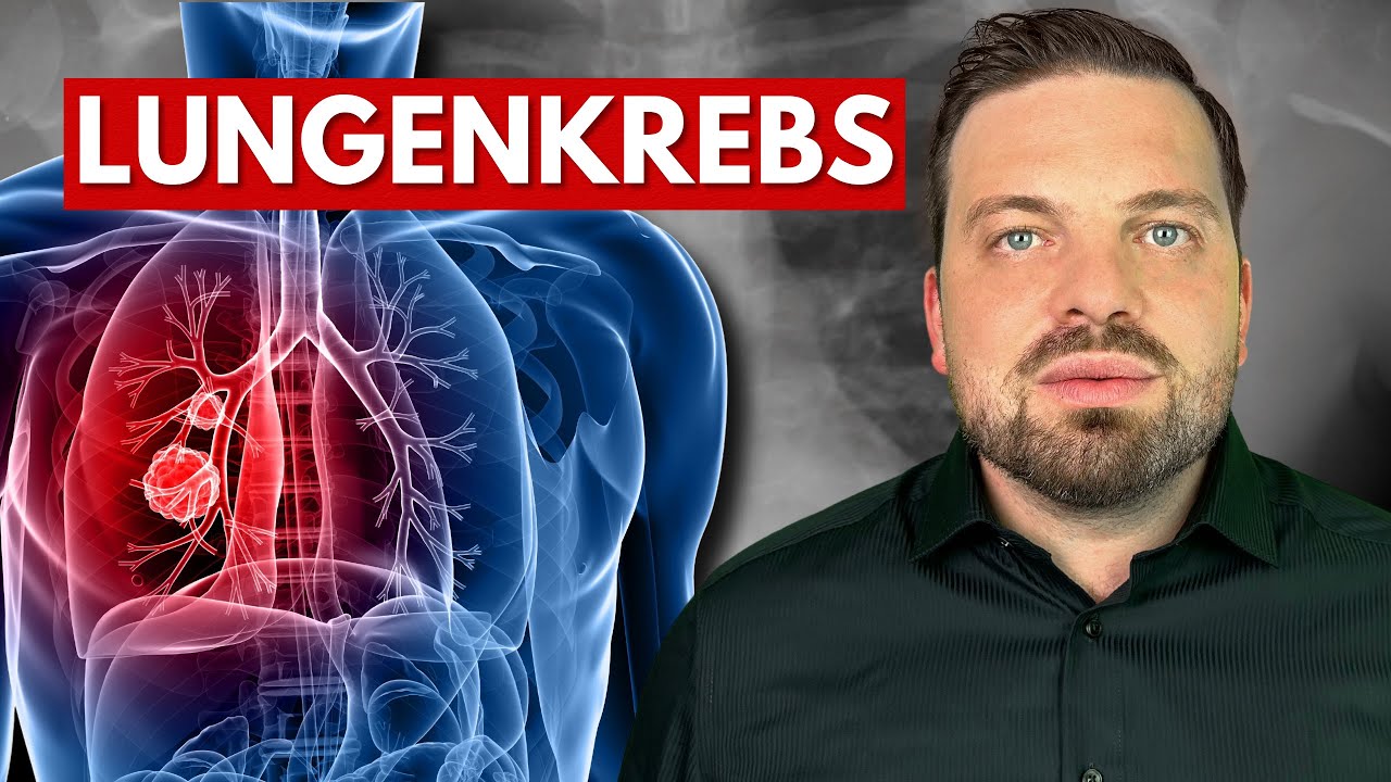 Lungenkrebs verstehen. Ursachen, Symptome, Diagnose & Therapie - YouTube