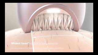 plucking hairs from root, epilator working.