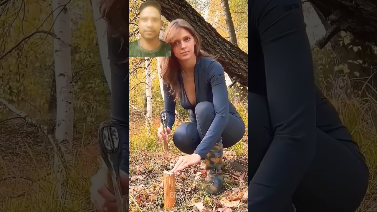 How To Avoid Finger Injuries (Advice from a Surgeon) 