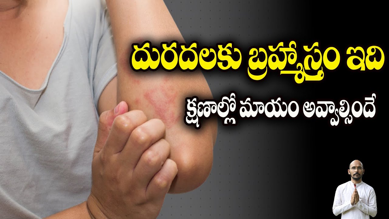 దురదలకు బ్రహ్మాస్త్రం ఇది... క్షణాల్లో మాయం అవ్వాల్సిందే| Dr.Madhu Babu Health Trends