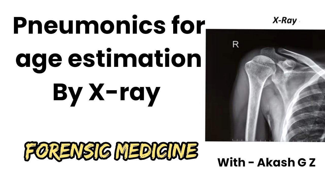 Pneumonics for age estimation by Xray FMT YouTube